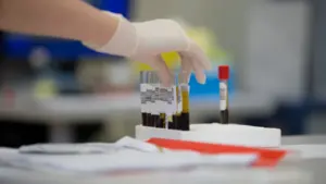 Gloved medical professional handling blood sample tubes in a clinical laboratory setting